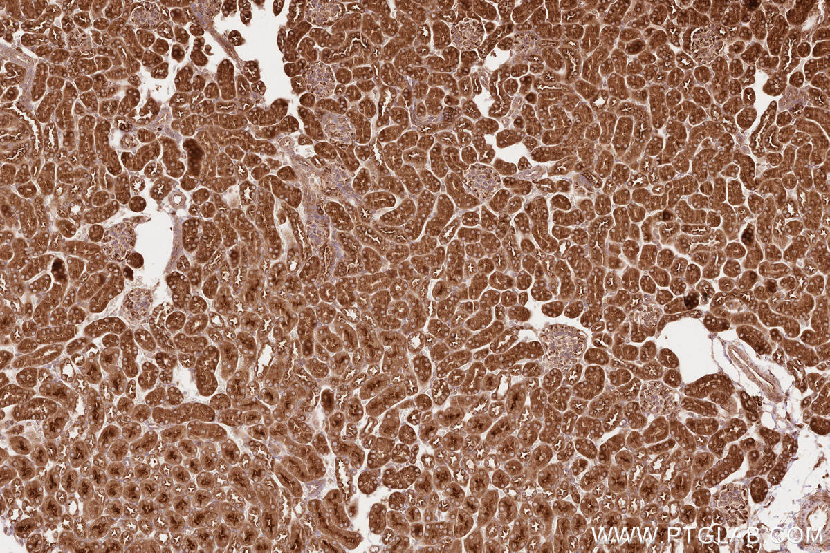Immunohistochemical analysis of paraffin-embedded mouse kidney tissue slide using KHC2612 (BZW1 IHC Kit).