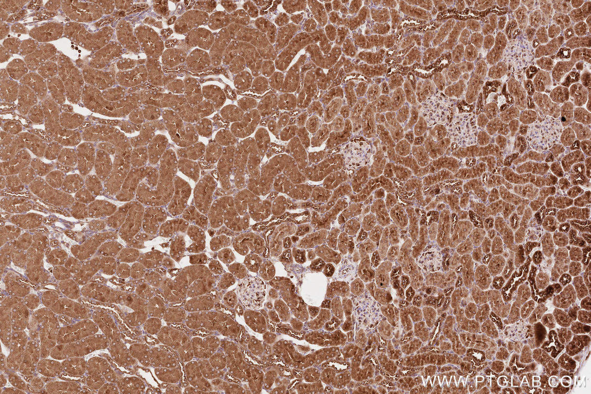 Immunohistochemical analysis of paraffin-embedded rat kidney tissue slide using KHC2612 (BZW1 IHC Kit).