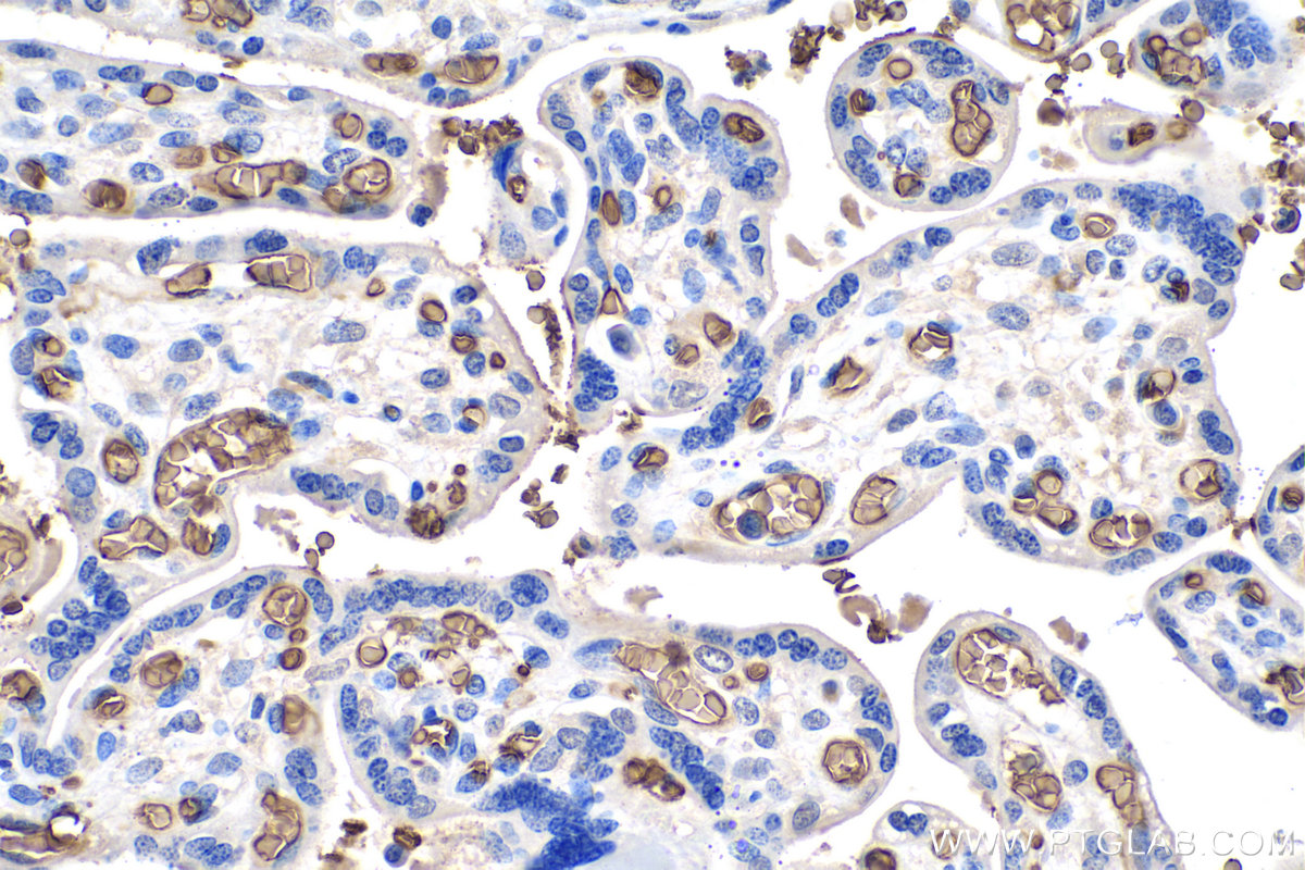 Immunohistochemical analysis of paraffin-embedded human placenta tissue slide using KHC0200 (band 3/ AE1 IHC Kit).