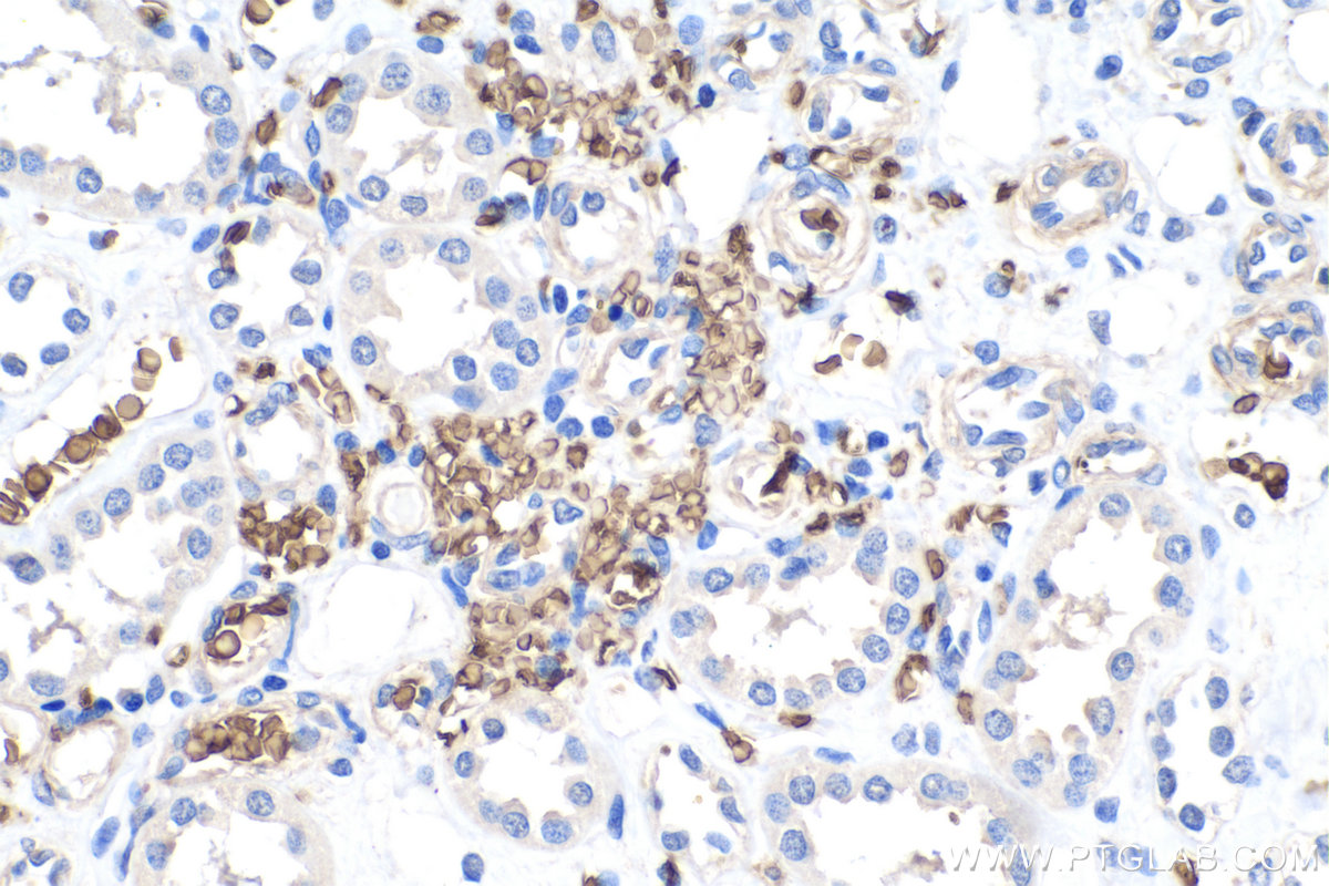 Immunohistochemical analysis of paraffin-embedded human kidney tissue slide using KHC0200 (band 3/ AE1 IHC Kit).