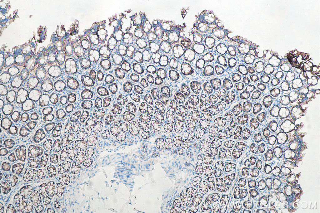 Immunohistochemical analysis of paraffin-embedded rat colon tissue slide using KHC0008 (Beta Catenin IHC Kit)