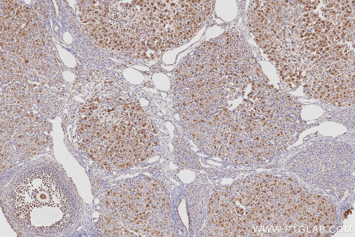 Immunohistochemical analysis of paraffin-embedded rat ovary tissue slide using KHC3070 (C15orf23 IHC Kit). Immunohistochemical analysis of paraffin-embedded rat ovary tissue slide using KHC3070 (C15orf23 IHC Kit).