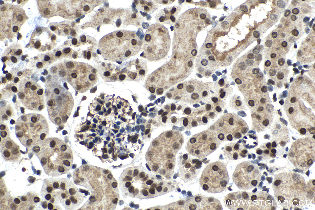 Immunohistochemical analysis of paraffin-embedded mouse kidney tissue slide using KHC1412 (C17orf49 IHC Kit).