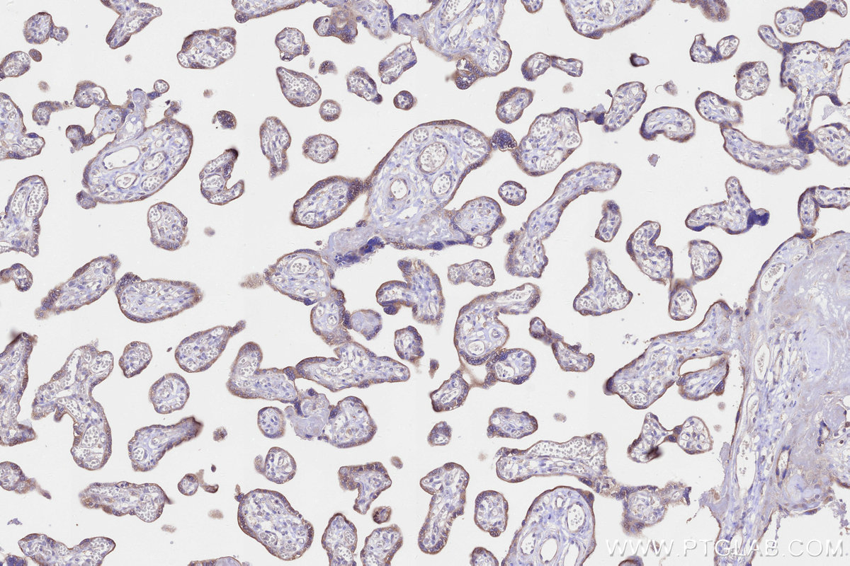 Immunohistochemical analysis of paraffin-embedded human placenta tissue slide using KHC3264 (C19orf63 IHC Kit).