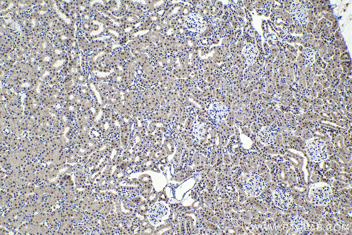 Immunohistochemical analysis of paraffin-embedded rat kidney tissue slide using KHC1722 (C1D IHC Kit).