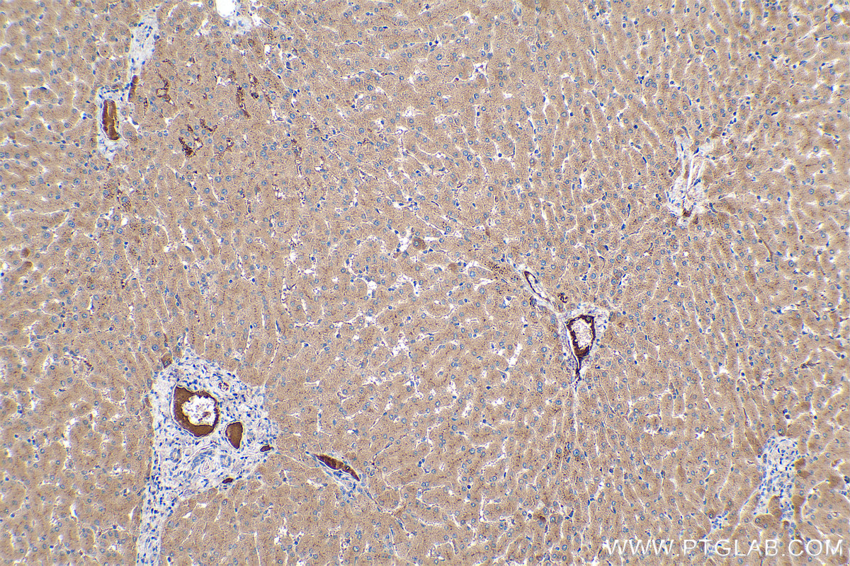 Immunohistochemical analysis of paraffin-embedded human liver tissue slide using KHC0404 (C1R IHC Kit).