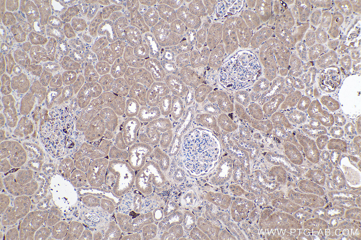 Immunohistochemical analysis of paraffin-embedded human kidney tissue slide using KHC0404 (C1R IHC Kit).