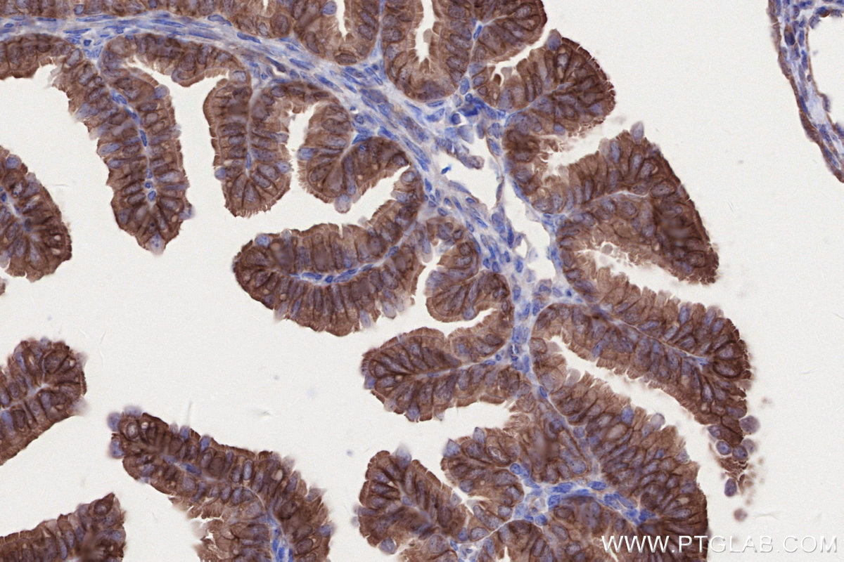 Immunohistochemical analysis of paraffin-embedded mouse ovary tissue slide using KHC2641 (C2CD5 IHC Kit).