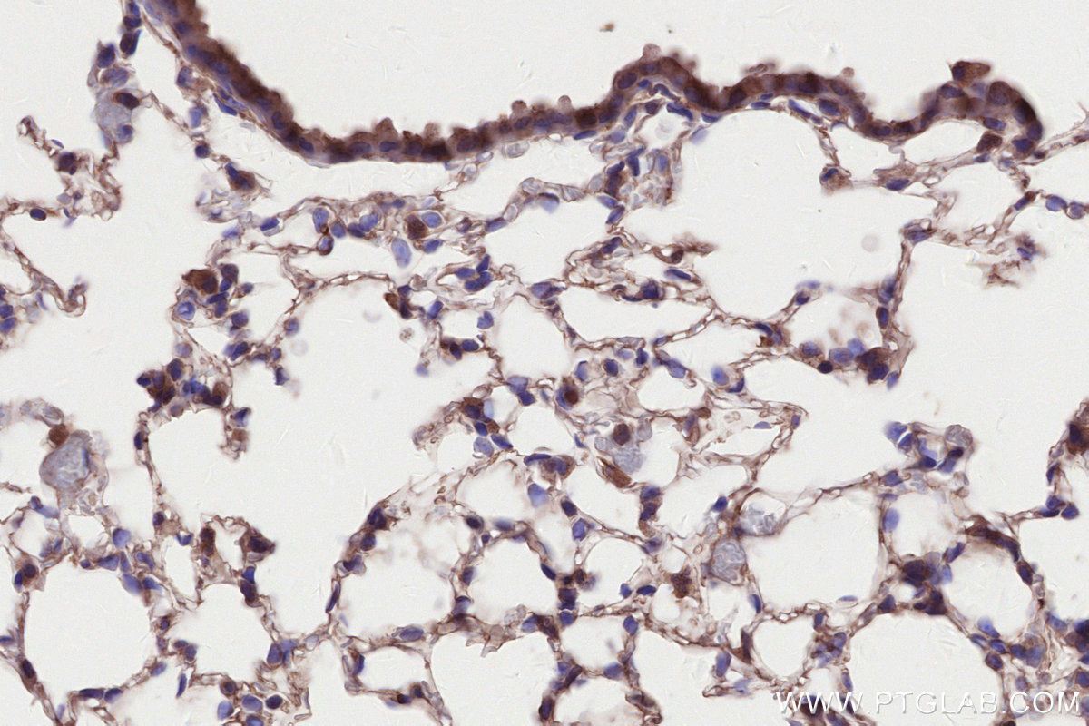 Immunohistochemical analysis of paraffin-embedded mouse lung tissue slide using KHC2641 (C2CD5 IHC Kit).