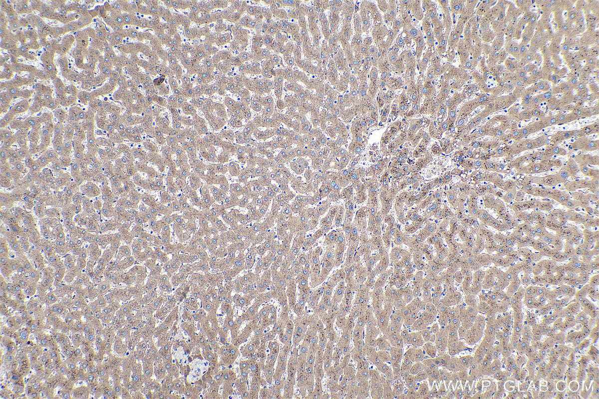 Immunohistochemical analysis of paraffin-embedded human liver tissue slide using KHC0375 (C3 IHC Kit).