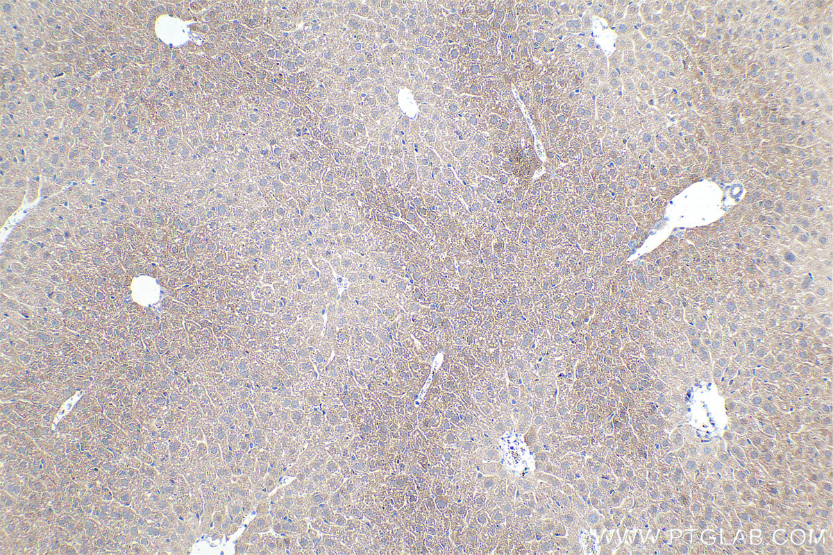 Immunohistochemical analysis of paraffin-embedded mouse liver tissue slide using KHC0375 (C3 IHC Kit).