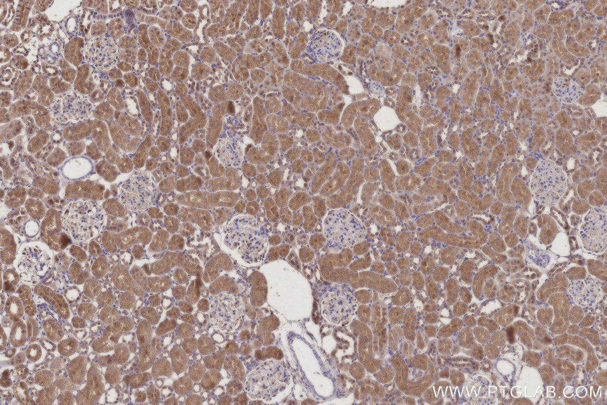 Immunohistochemical analysis of paraffin-embedded rat kidney tissue slide using KHC2945 (C8orf4 IHC Kit).