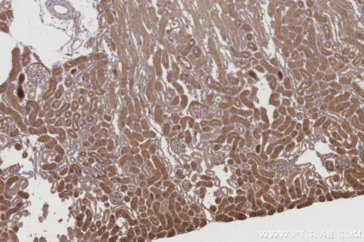 Immunohistochemical analysis of paraffin-embedded mouse kidney tissue slide using KHC2945 (C8orf4 IHC Kit).