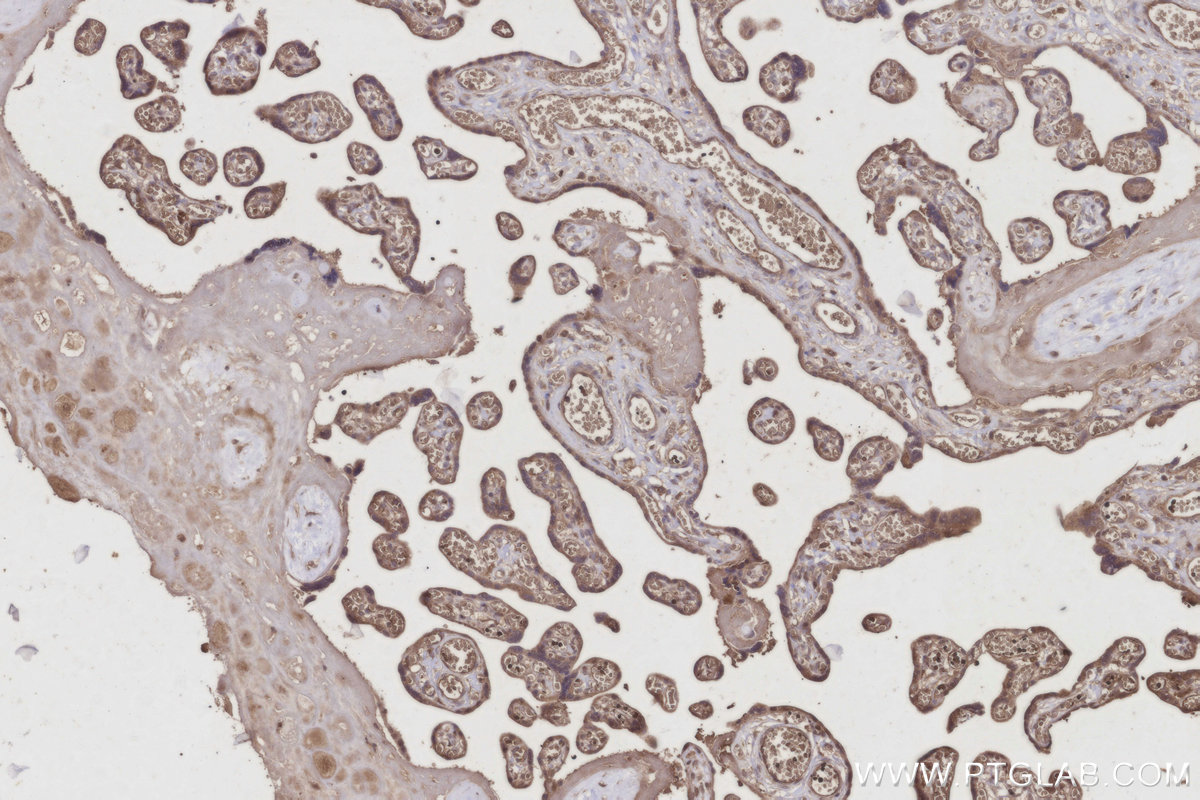 Immunohistochemical analysis of paraffin-embedded human placenta tissue slide using KHC2945 (C8orf4 IHC Kit).