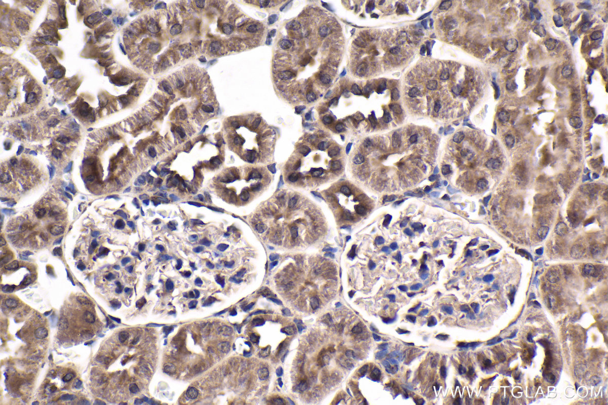 Immunohistochemical analysis of paraffin-embedded rat kidney tissue slide using KHC1878 (C9orf72 IHC Kit).