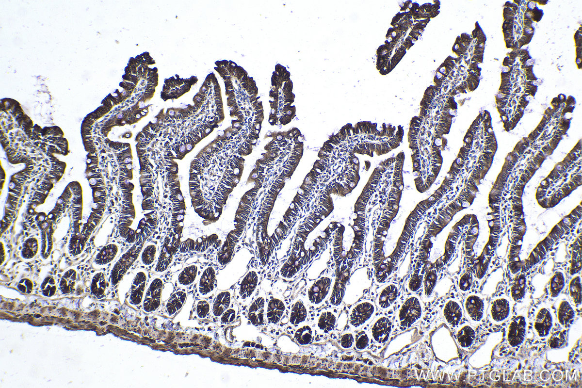 Immunohistochemical analysis of paraffin-embedded rat small intestine tissue slide using KHC1878 (C9orf72 IHC Kit).