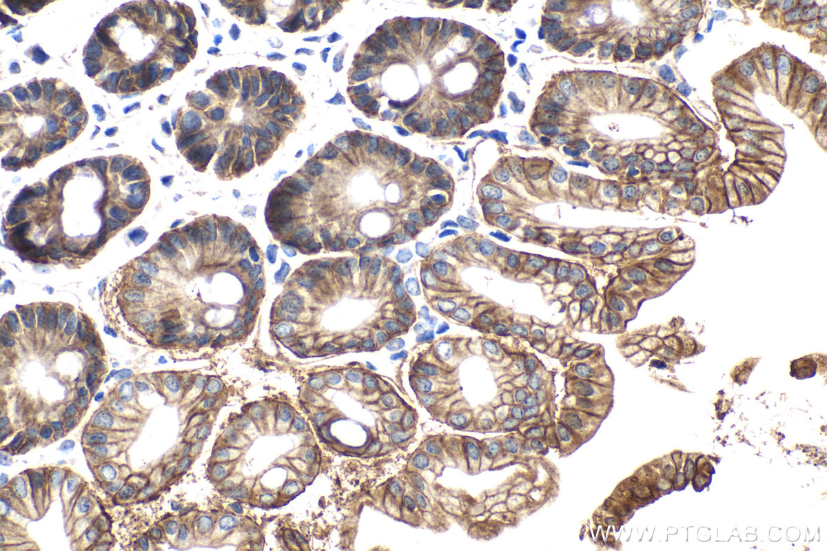 Immunohistochemical analysis of paraffin-embedded mouse  intestine tissue slide using KHC2088 (CA12 IHC Kit).