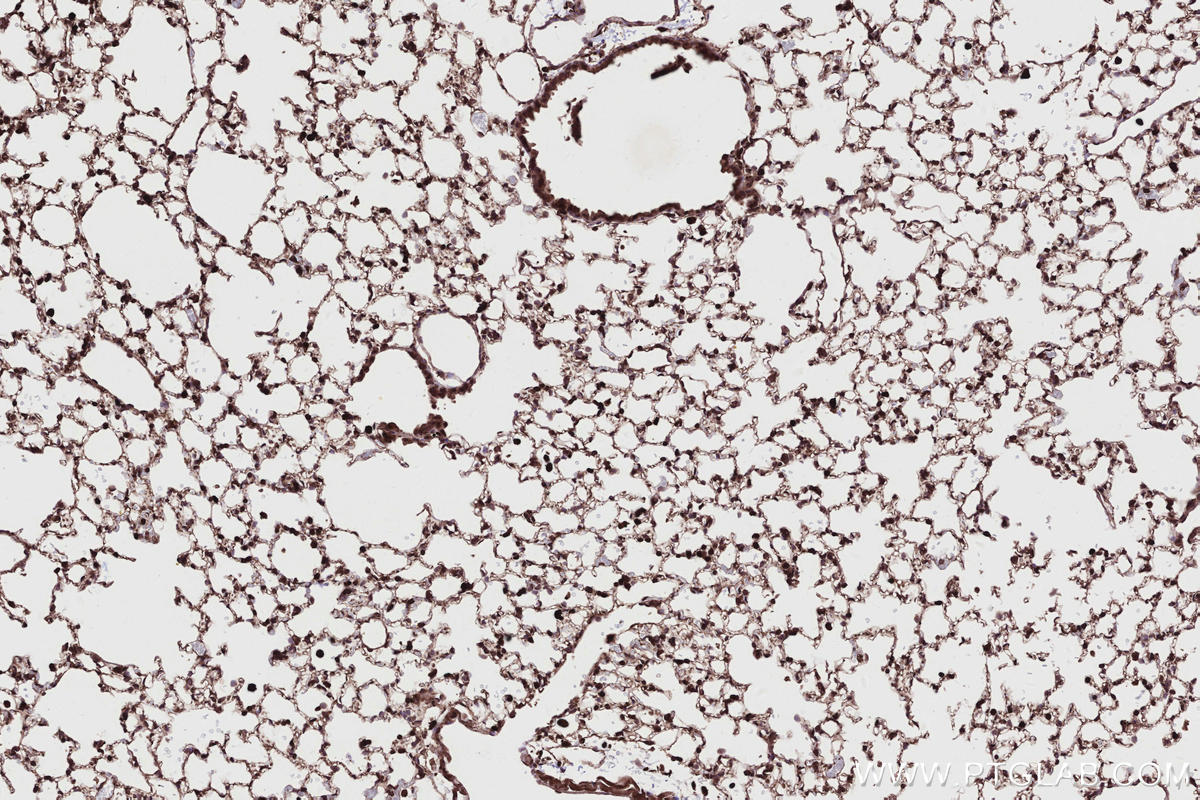 Immunohistochemical analysis of paraffin-embedded mouse lung tissue slide using KHC2719 (CABLES1 IHC Kit).