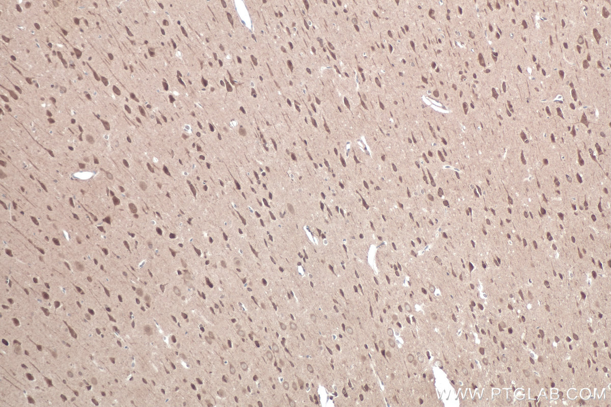 Immunohistochemical analysis of paraffin-embedded rat brain tissue slide using KHC0868 (CACYBP IHC Kit).