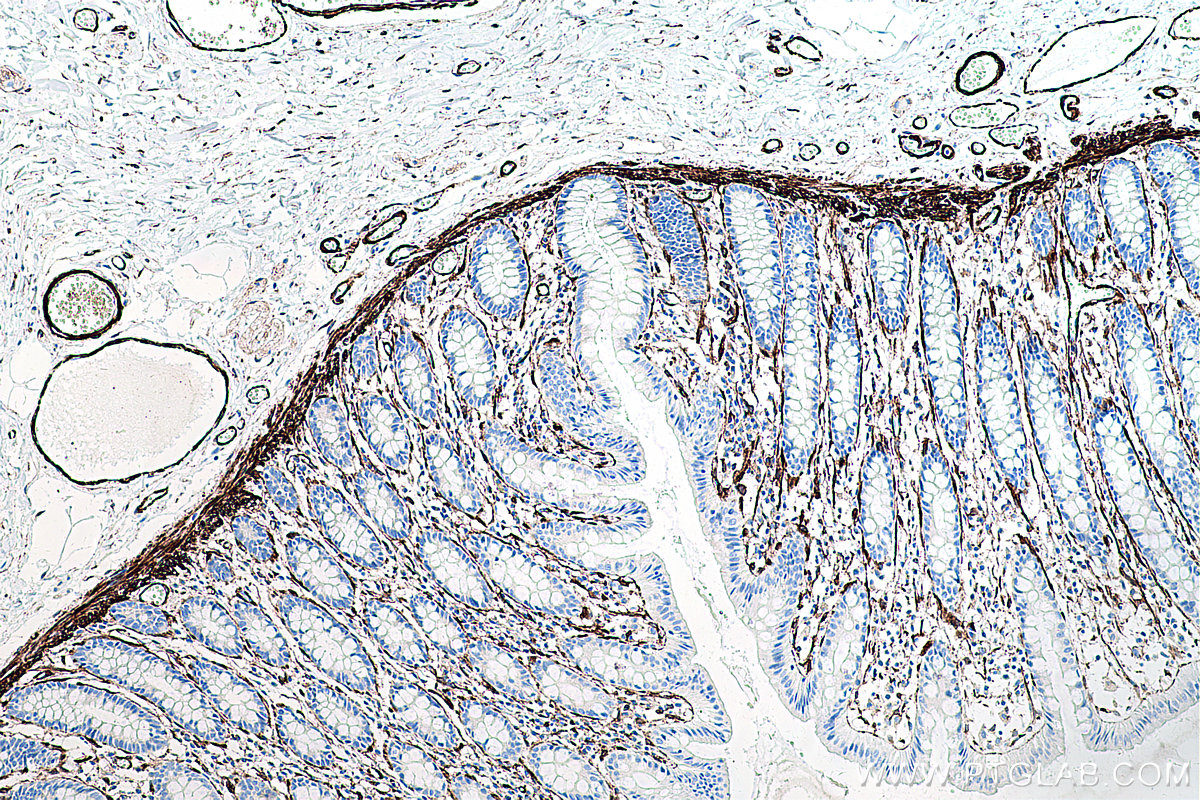 Immunohistochemical analysis of paraffin-embedded human colon tissue slide using KHC0274 (CALD1 IHC Kit).