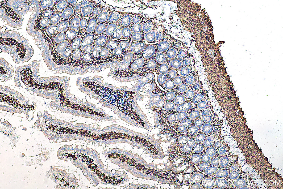 Immunohistochemical analysis of paraffin-embedded rat small intestine tissue slide using KHC0274 (CALD1 IHC Kit).