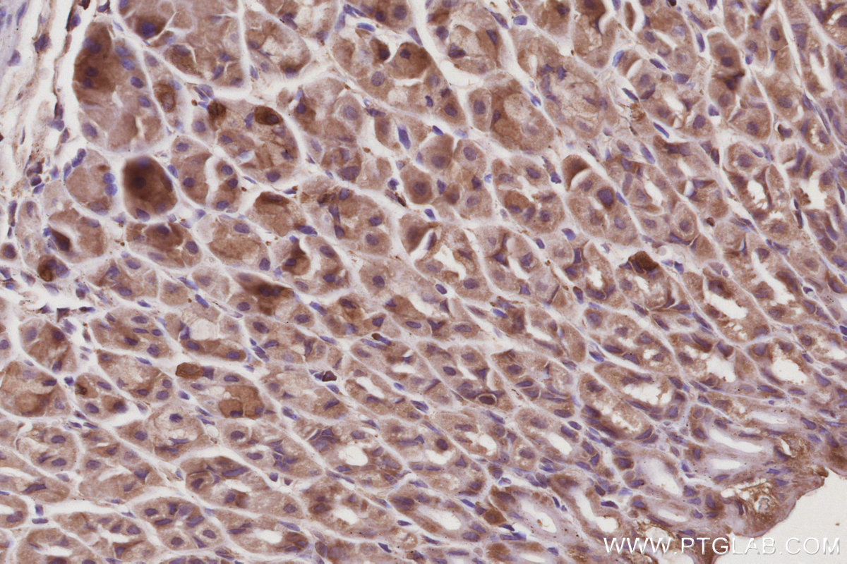 Immunohistochemical analysis of paraffin-embedded mouse stomach tissue slide using KHC3050 (CAMK2A IHC Kit). Immunohistochemical analysis of paraffin-embedded mouse stomach tissue slide using KHC3050 (CAMK2A IHC Kit).