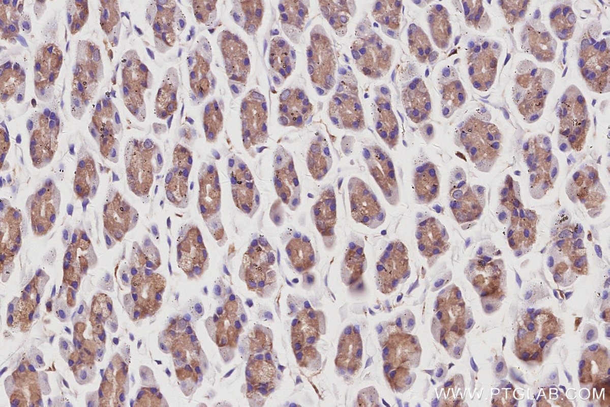 Immunohistochemical analysis of paraffin-embedded rat stomach tissue slide using KHC3050 (CAMK2A IHC Kit). Immunohistochemical analysis of paraffin-embedded rat stomach tissue slide using KHC3050 (CAMK2A IHC Kit).