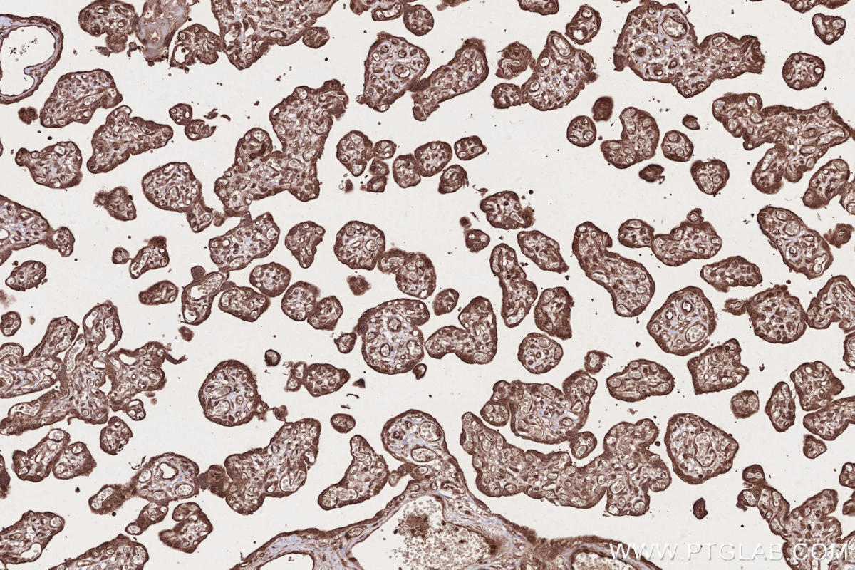 Immunohistochemical analysis of paraffin-embedded human placenta tissue slide using KHC2677 (CAMKK1 IHC Kit).