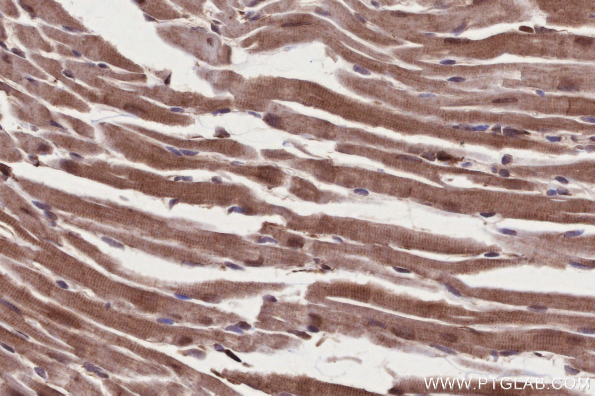 Immunohistochemical analysis of paraffin-embedded mouse heart tissue slide using KHC2677 (CAMKK1 IHC Kit).