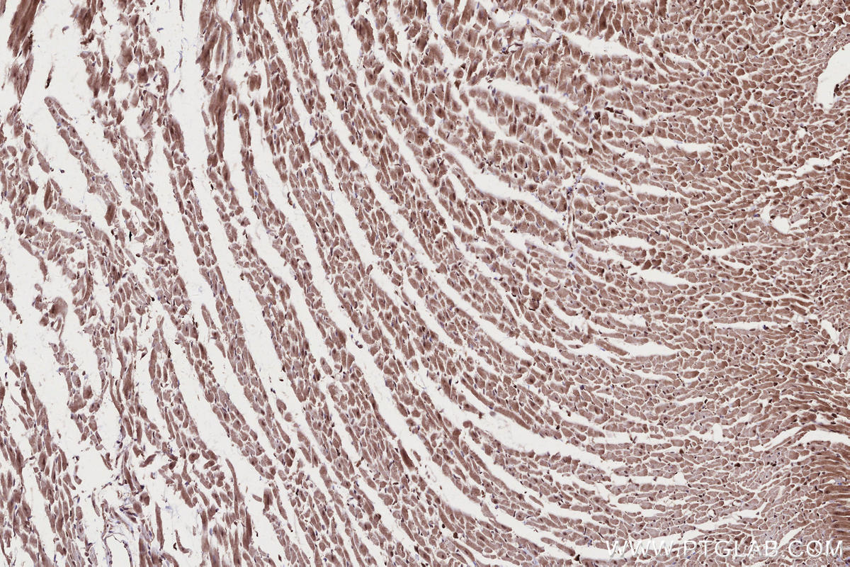 Immunohistochemical analysis of paraffin-embedded rat heart tissue slide using KHC2677 (CAMKK1 IHC Kit).