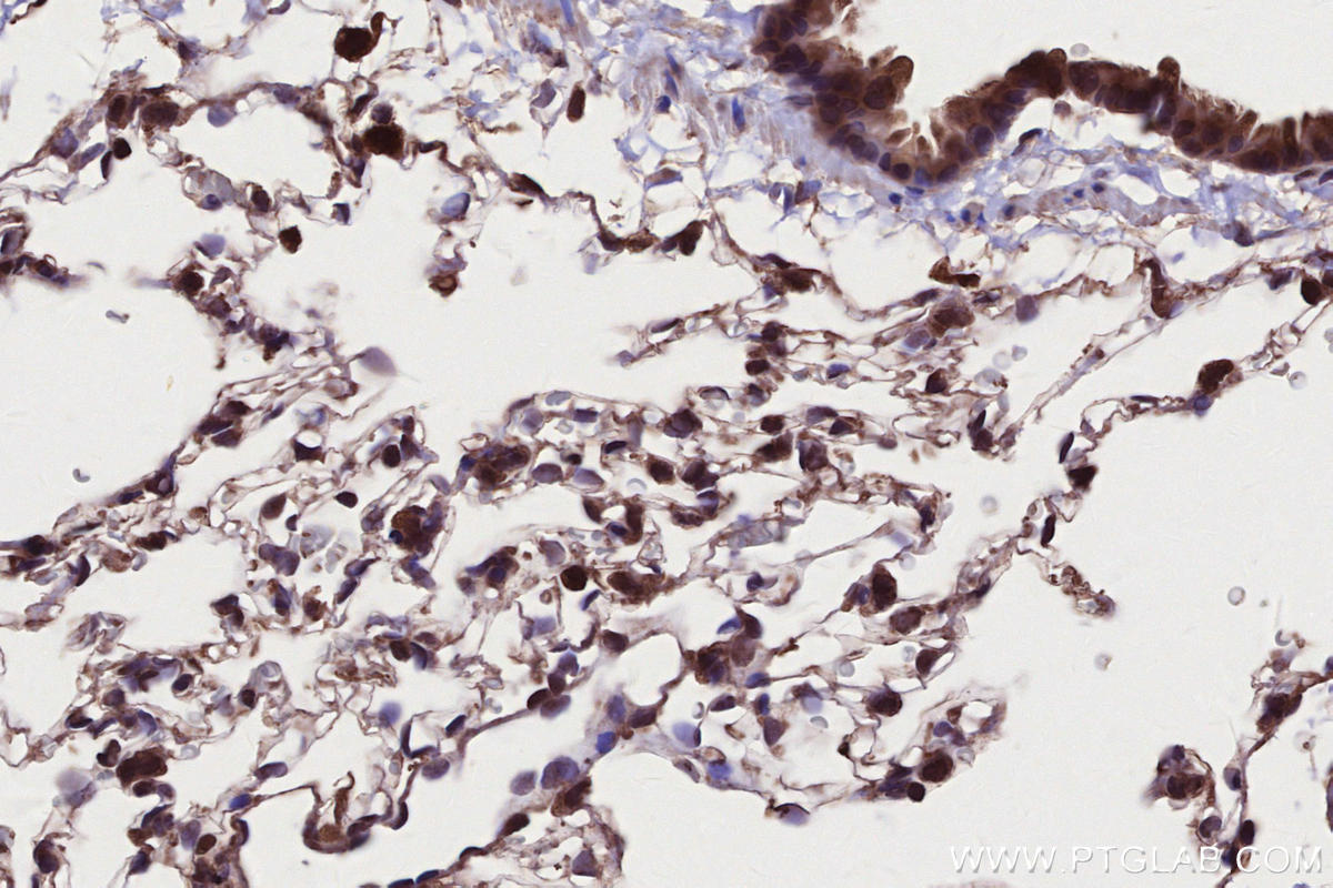 Immunohistochemical analysis of paraffin-embedded rat lung tissue slide using KHC2677 (CAMKK1 IHC Kit).