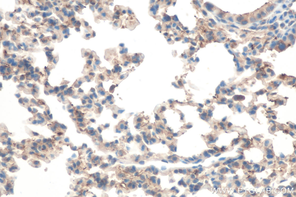 Immunohistochemical analysis of paraffin-embedded mouse lung tissue slide using KHC0835 (CAP1 IHC Kit).