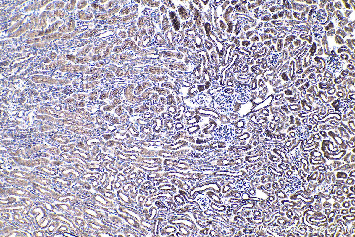 Immunohistochemical analysis of paraffin-embedded mouse kidney tissue slide using KHC0969 (CAP2 IHC Kit).