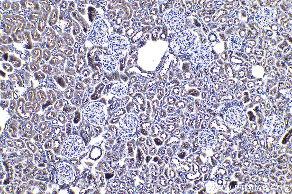 Immunohistochemical analysis of paraffin-embedded rat kidney tissue slide using KHC0969 (CAP2 IHC Kit).