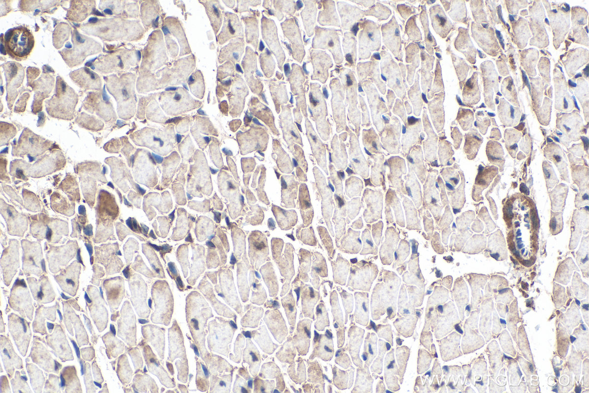 Immunohistochemical analysis of paraffin-embedded mouse heart tissue slide using KHC0318 (CAPN3 IHC Kit).