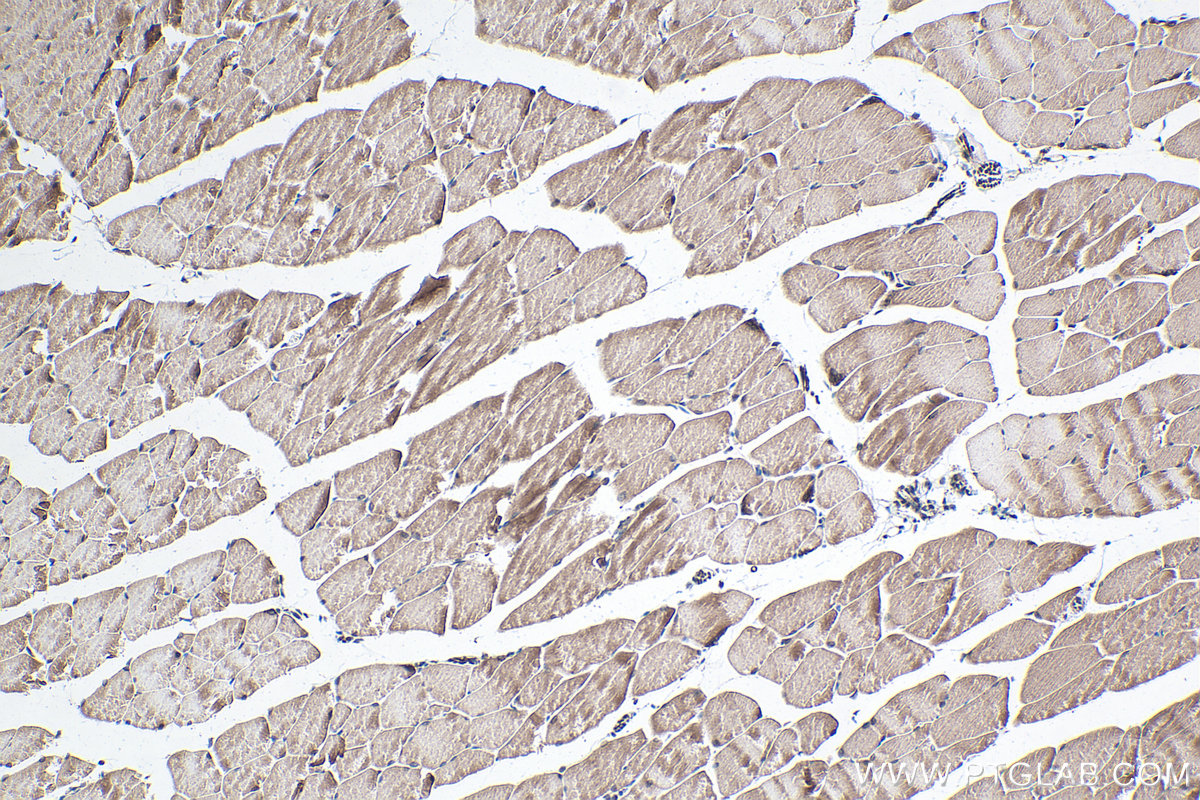 Immunohistochemical analysis of paraffin-embedded mouse skeletal muscle tissue slide using KHC0323 (CAPN3 IHC Kit).