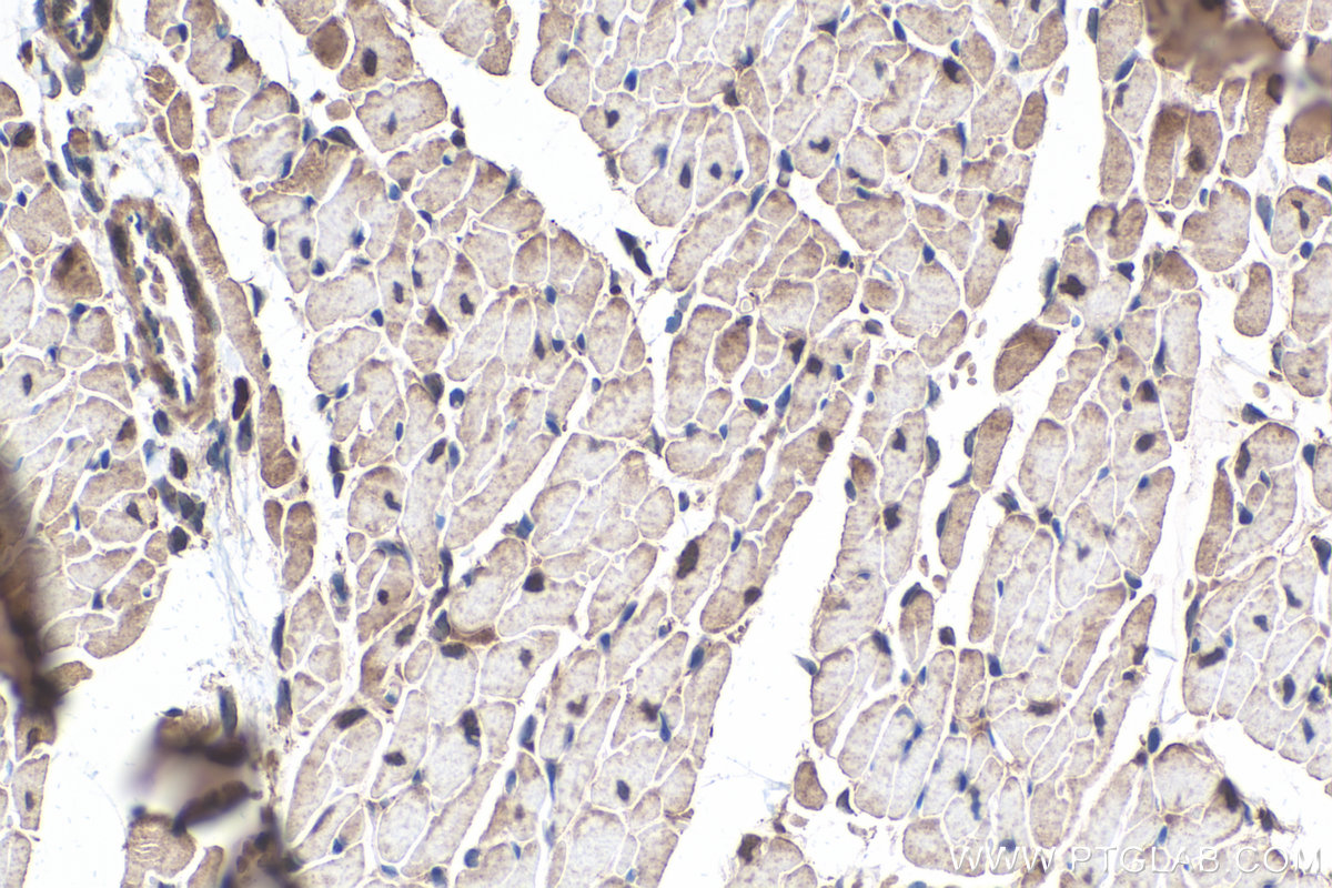 Immunohistochemical analysis of paraffin-embedded mouse heart tissue slide using KHC0323 (CAPN3 IHC Kit).