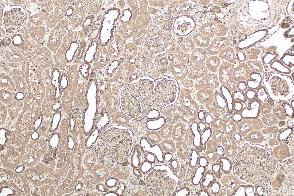 Immunohistochemical analysis of paraffin-embedded human kidney tissue slide using KHC0683 (CAPNS1 IHC Kit).