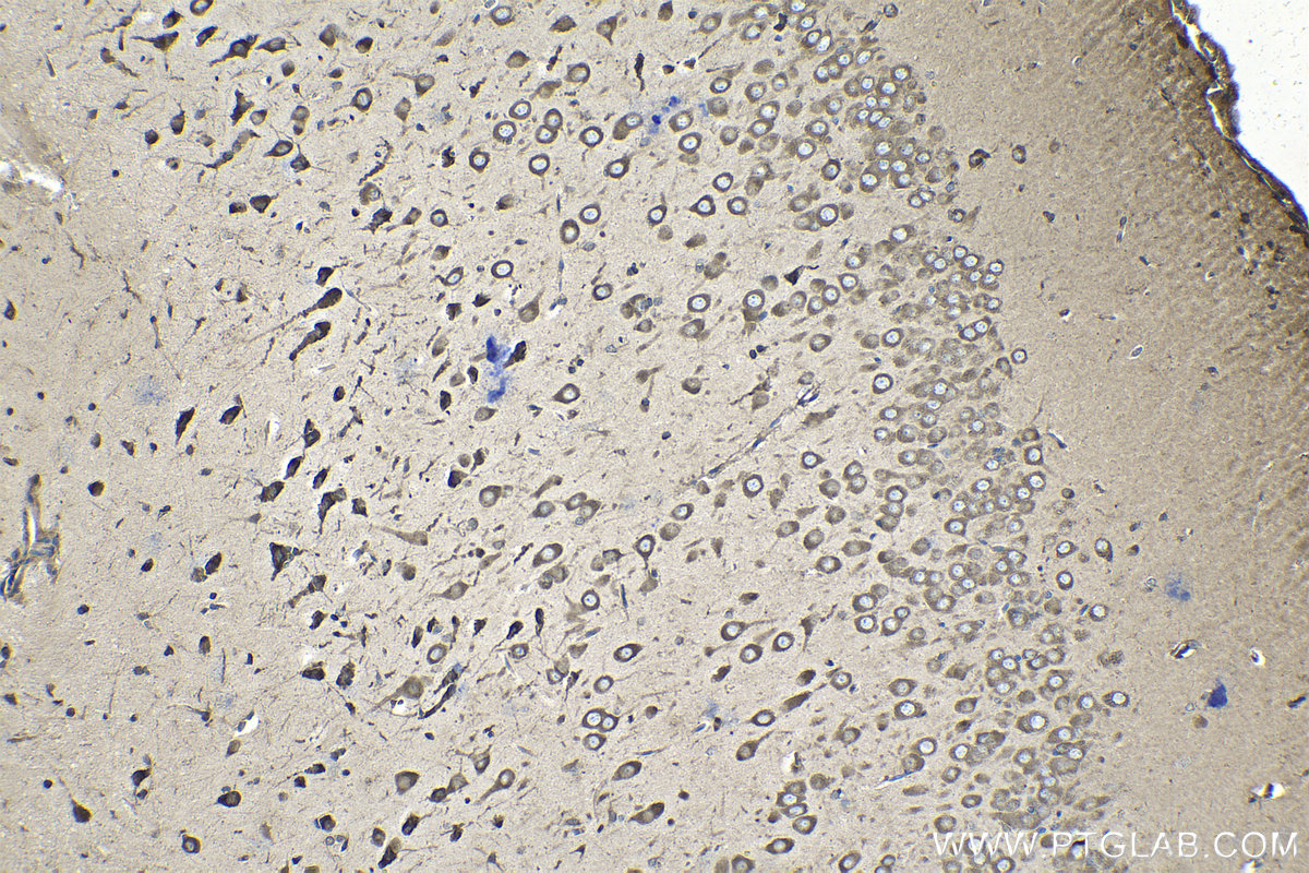 Immunohistochemical analysis of paraffin-embedded rat brain tissue slide using KHC1395 (CAPRIN1 IHC Kit).