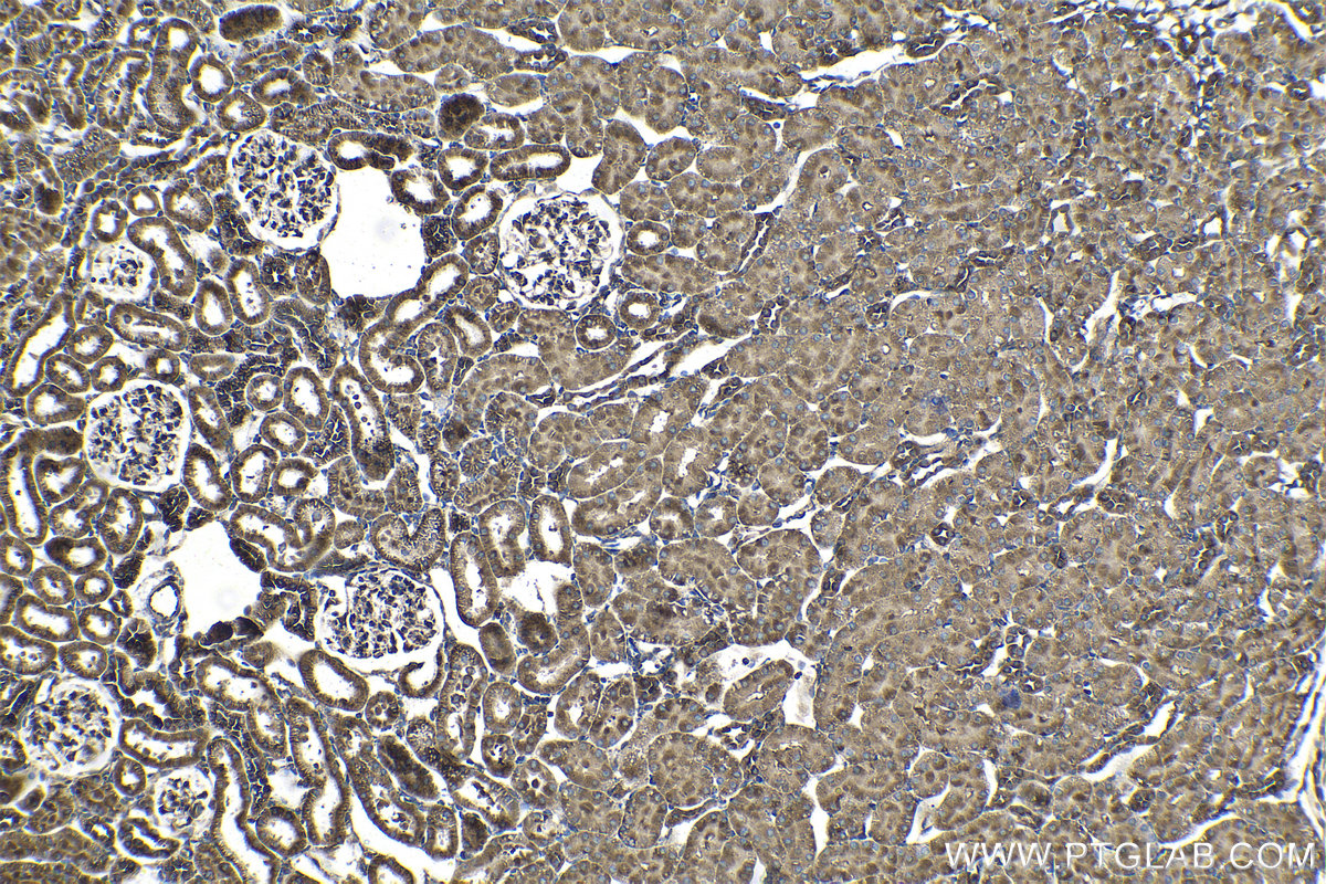 Immunohistochemical analysis of paraffin-embedded rat kidney tissue slide using KHC1395 (CAPRIN1 IHC Kit).