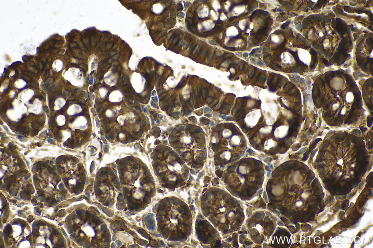 Immunohistochemical analysis of paraffin-embedded mouse colon tissue slide using KHC0707 (CAPZB IHC Kit).