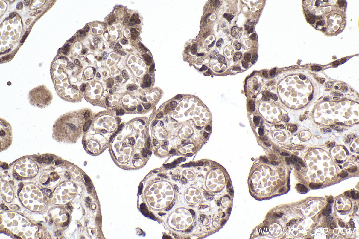 Immunohistochemical analysis of paraffin-embedded human placenta tissue slide using KHC2014 (CARD8 IHC Kit).