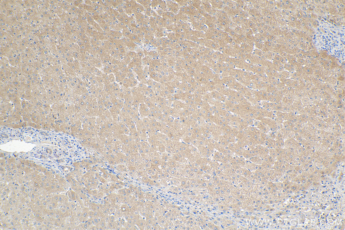 Immunohistochemical analysis of paraffin-embedded human liver tissue slide using KHC2014 (CARD8 IHC Kit).