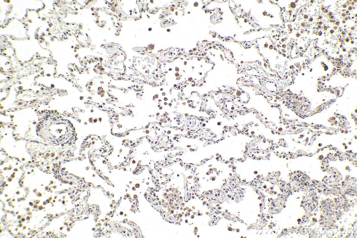 Immunohistochemical analysis of paraffin-embedded human lung tissue slide using KHC2014 (CARD8 IHC Kit).