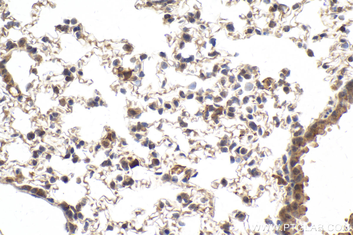 Immunohistochemical analysis of paraffin-embedded mouse lung tissue slide using KHC2014 (CARD8 IHC Kit).