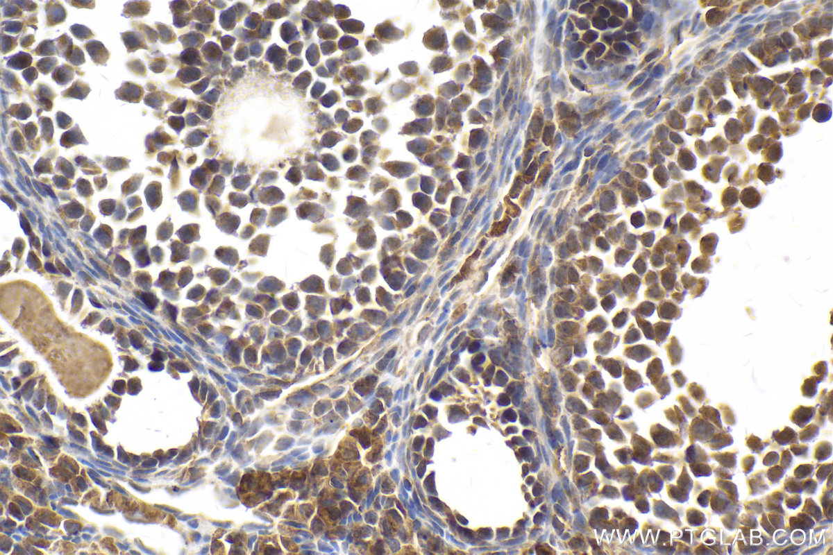 Immunohistochemical analysis of paraffin-embedded mouse ovary tissue slide using KHC2014 (CARD8 IHC Kit).