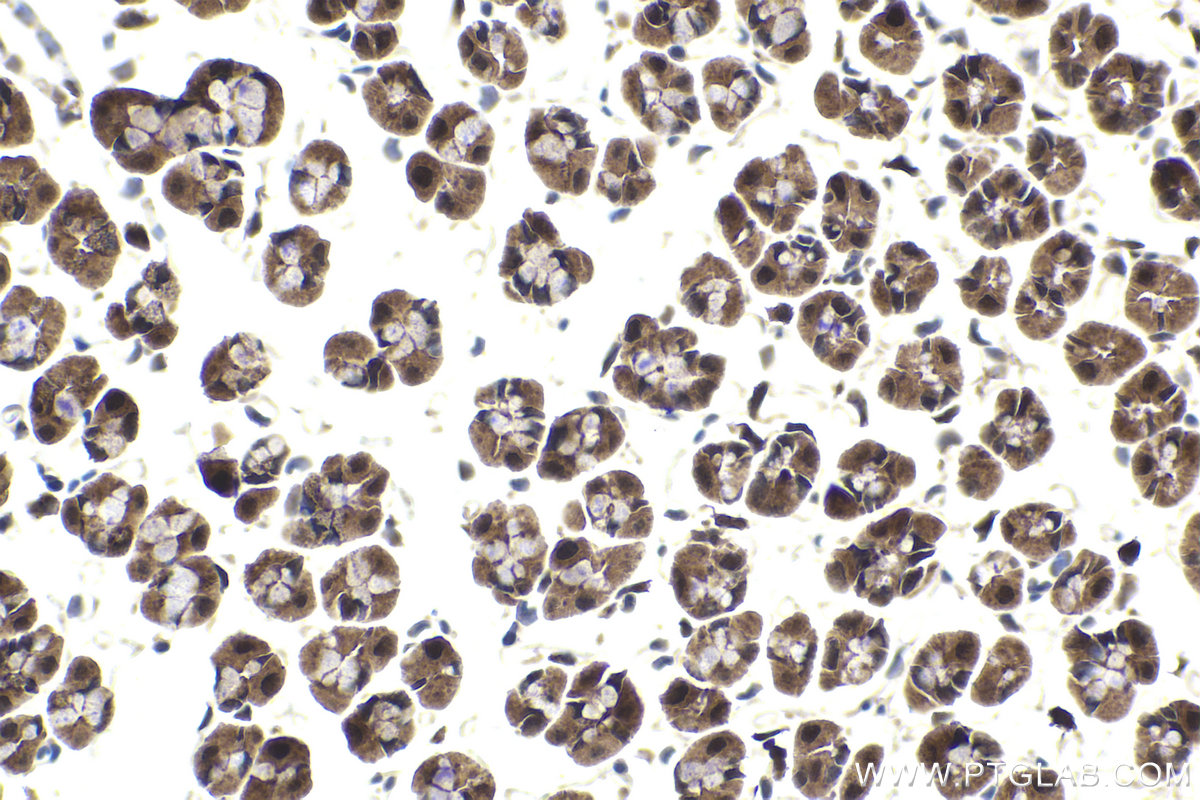 Immunohistochemical analysis of paraffin-embedded rat stomach tissue slide using KHC1810 (CARM1 IHC Kit).