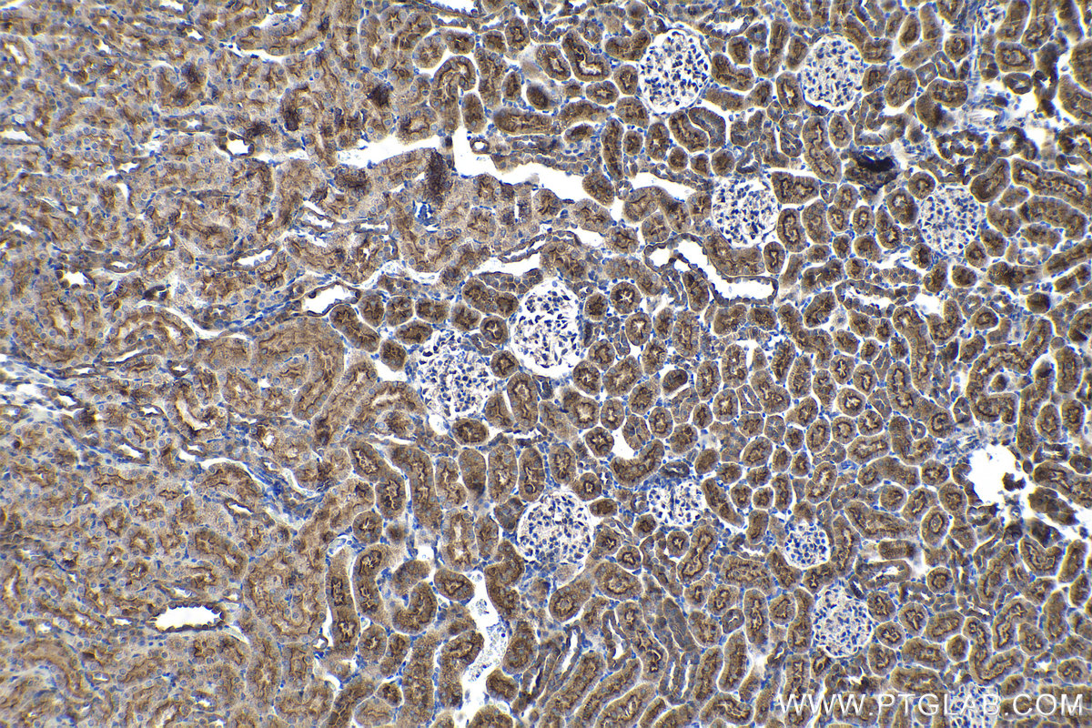 Immunohistochemical analysis of paraffin-embedded rat kidney tissue slide using KHC1433 (CASK IHC Kit).