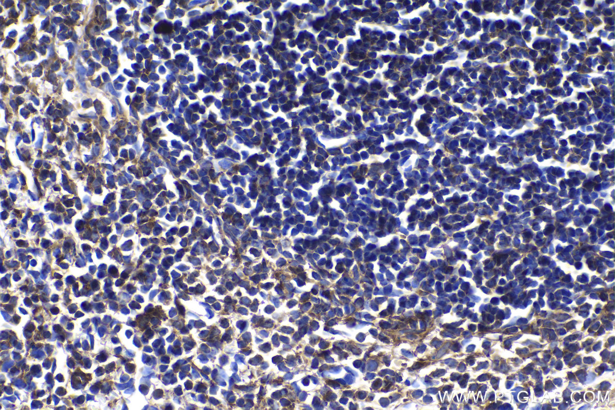 Immunohistochemical analysis of paraffin-embedded mouse spleen tissue slide using KHC1050 (CBL IHC Kit).