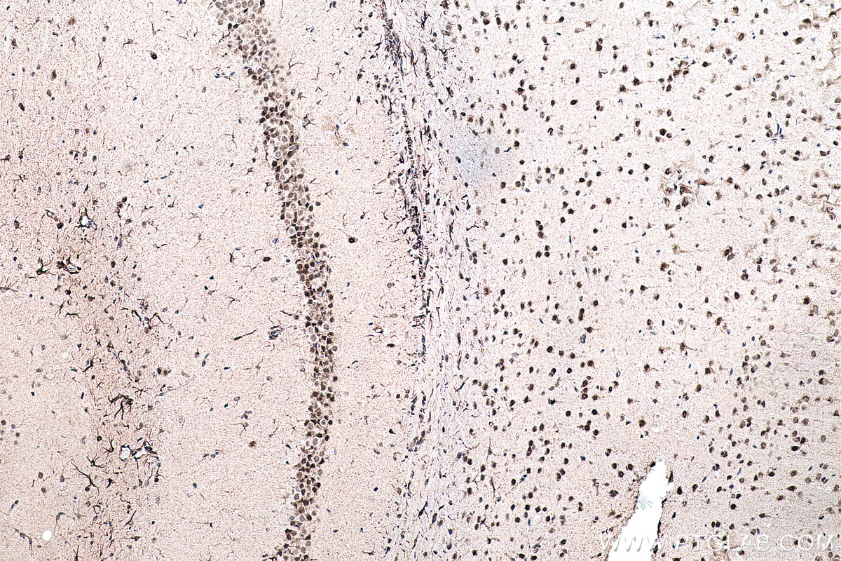 Immunohistochemical analysis of paraffin-embedded mouse brain tissue slide using KHC0152 (CBLL1 IHC Kit).